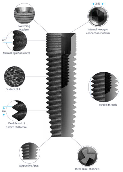 dental implants classic-details